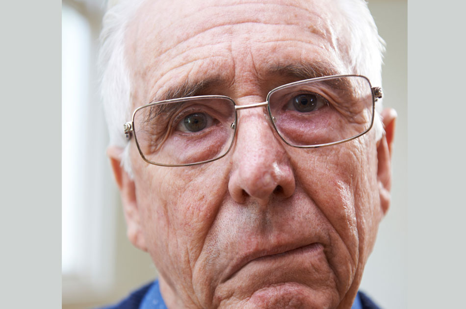 Älterer Mann nach einem Schlaganfall. Erkennen kann man dies an dem schrägen Mundwinkel.